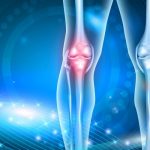 Osteoartrit Nedir sebepleri nelerdir