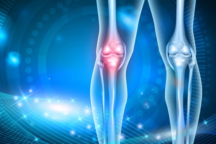 Osteoartrit Nedir sebepleri nelerdir