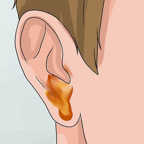 orta kulak iltihabi nedir